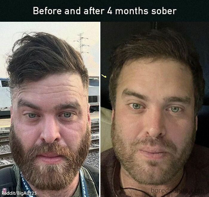Before and after photos of a man, showing positive transformation and uplift after 4 months of sobriety.