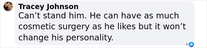 Comment criticizing Jimmy Carr's cosmetic surgery decisions.