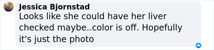 Comment expressing concern over astronaut's health, mentioning color change and liver check.