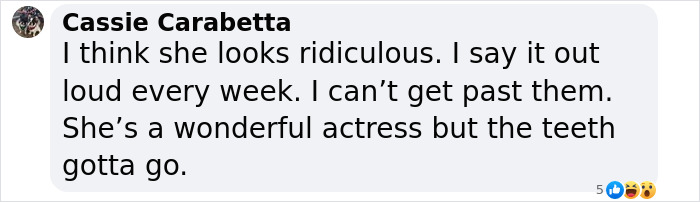 Social media comment criticizing Aimee Lou Wood's teeth, calling her "ridiculous" but acknowledging her acting talent.