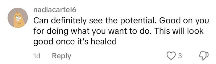 Social media comment supporting woman after rhinoplasty surgery.