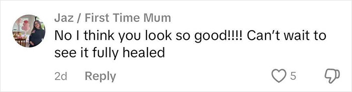 Comment expressing support after woman's rhinoplasty, saying she looks good and anticipating full healing.