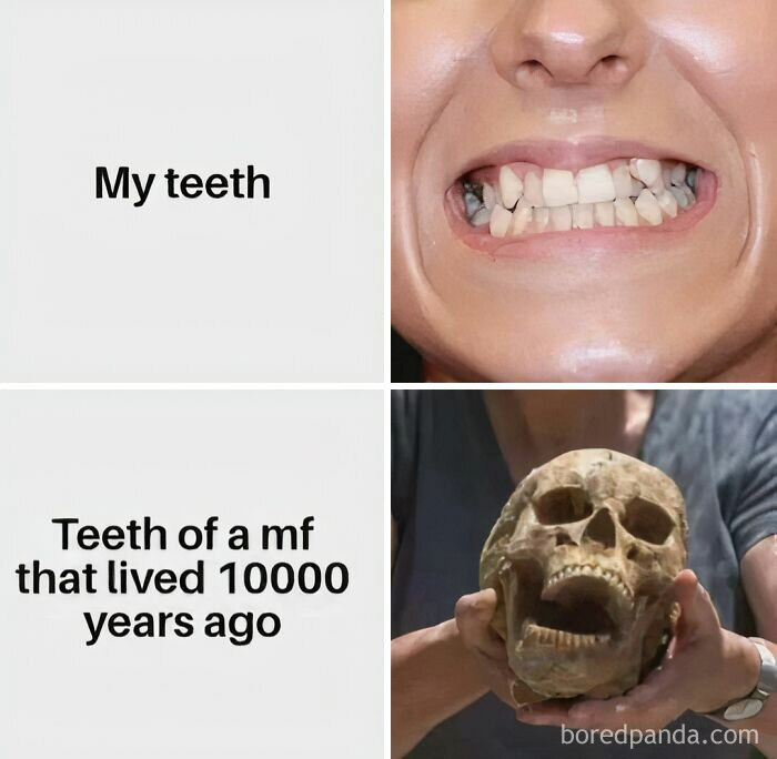 Funny meme comparing modern and ancient teeth from Diary Introverts.