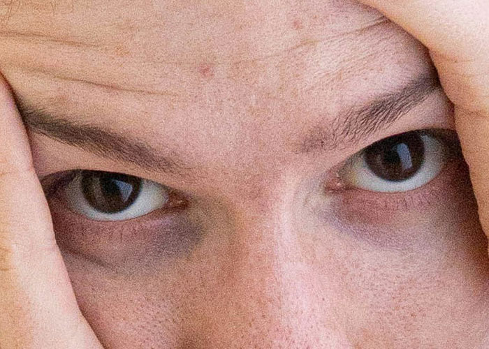 Close-up of a person's anxious eyes, reflecting a "need to leave" experience.