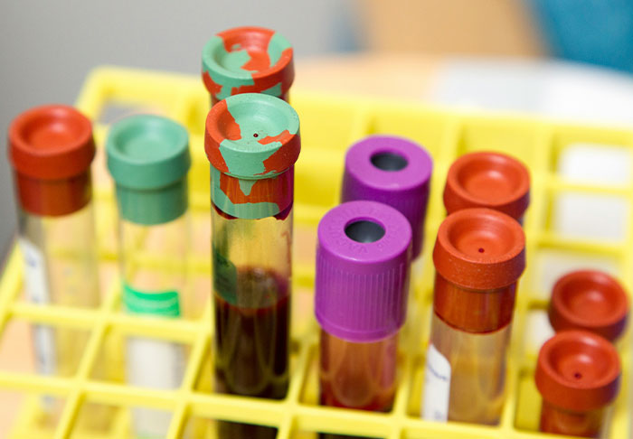 Blood test vials in a rack, highlighting disturbing facts in medical research.