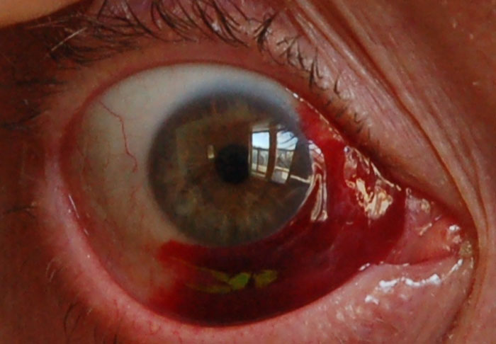 Close-up of a human eye with a red sclera, illustrating disturbing facts about eye health.