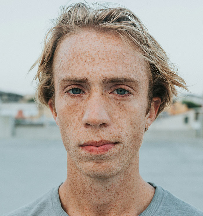 Rostro de joven con expresión seria, implicando traumas en su vida, fondo urbano borroso.