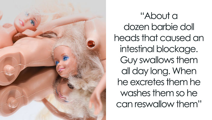 30 Times Doctors Found Something So Disturbing Inside A Body, They Had To Share It
