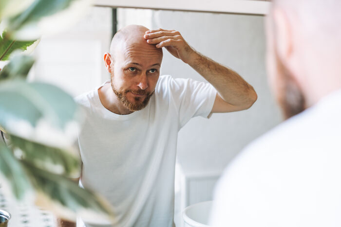 Man checking his receding hairline in the mirror, highlighting gradually disappeared things.