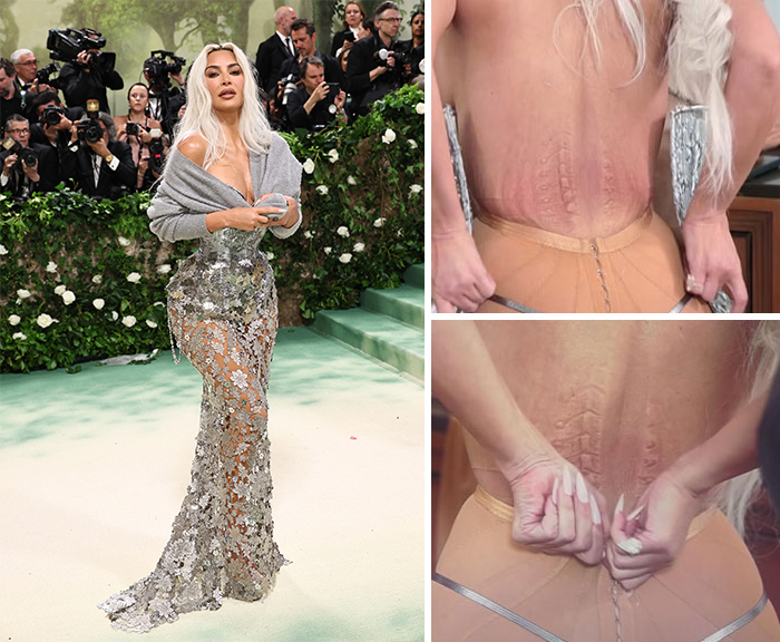 Celebrity on red carpet in a silver gown experiencing discomfort, highlighting fashion challenges at events.