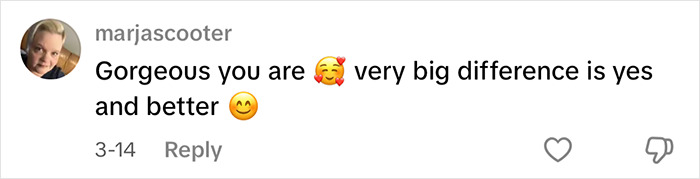 Comment praising YouTube influencer after eyelid surgery, expressing admiration and noting improvement. Comment praising YouTube influencer after eyelid surgery, expressing admiration and noting improvement.