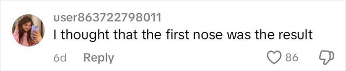 Social media comment discussing a botched nose job, showing surprise at the expected outcome.