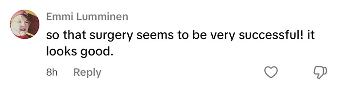 Comment praising eyelid surgery results by a YouTube influencer, noting its success and appearance. Comment praising eyelid surgery results by a YouTube influencer, noting its success and appearance.