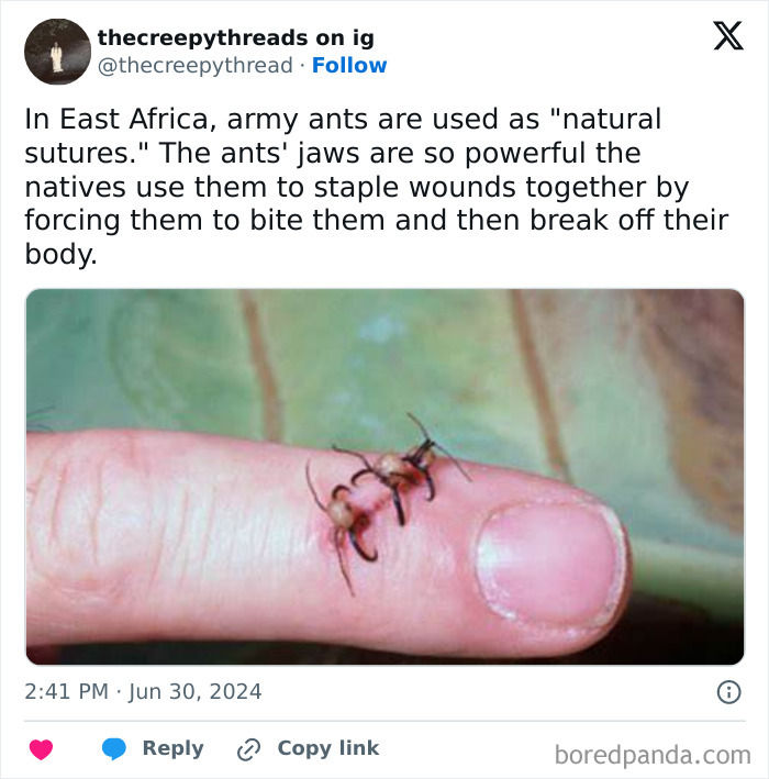Close-up of army ants biting a finger to act as natural sutures, a spooky fact about our world’s unusual medical practices.