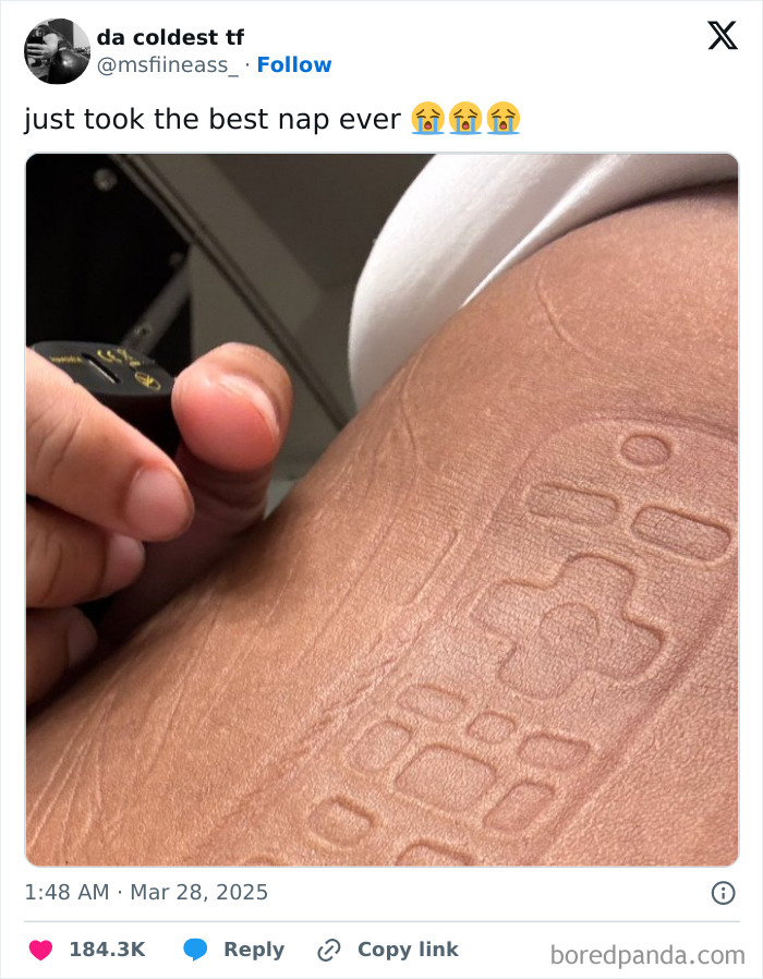 Hand holding a remote, imprint left on arm after sleeping, capturing one of the funniest tweets from April.