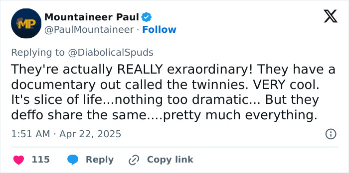 Tweet discussing twins' documentary, mentioning their extraordinary nature and shared experiences. Tweet discussing twins' documentary, mentioning their extraordinary nature and shared experiences.