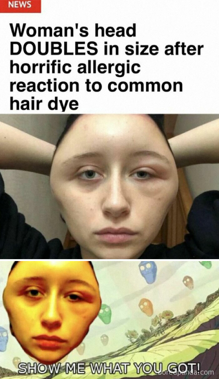 Funny meme of a woman with a swollen head after hair dye reaction, with a humorous alien cartoon comparison.