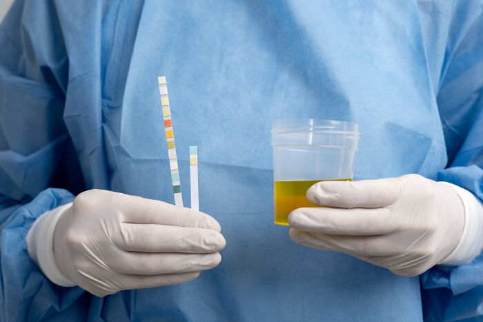 Medical professional in scrubs holding urine sample and test strips, illustrating weird practices.