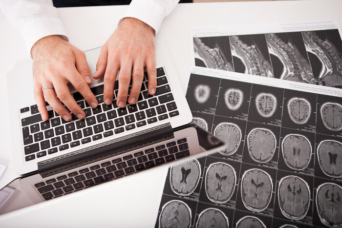 Person typing on a laptop beside MRI brain scans, highlighting overlooked scientific breakthroughs.