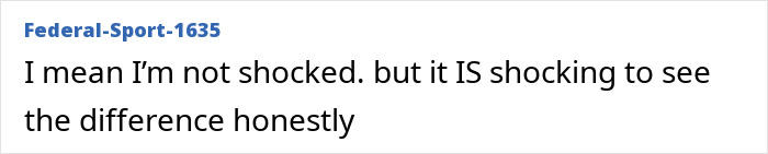 &ldquo;They All Want To Look Like Kim&rdquo;: Khloe Kardashian Faces Backlash Over "Botched" Nose Photo Fail