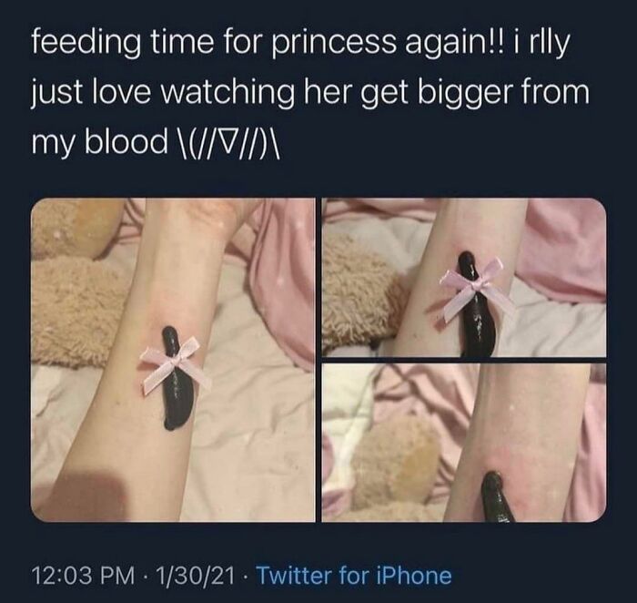Person displays cringe-worthy behavior by attaching a leech with a pink ribbon to their arm.