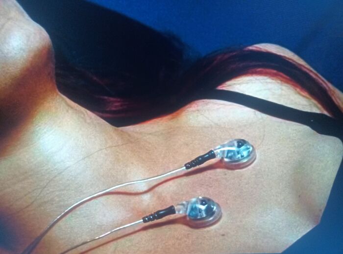 Creative filmmakers' prop showing clear suction cups on a person's skin, demonstrating innovative use in film.