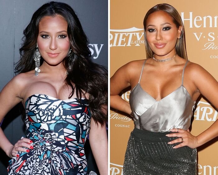Side-by-side photo of a celebrity before and after breast implant removal, wearing a patterned dress and silver top.