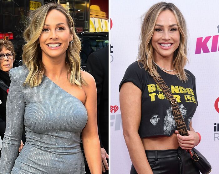 Celebrity side-by-side: before and after breast implant removal, smiling and wearing stylish outfits.