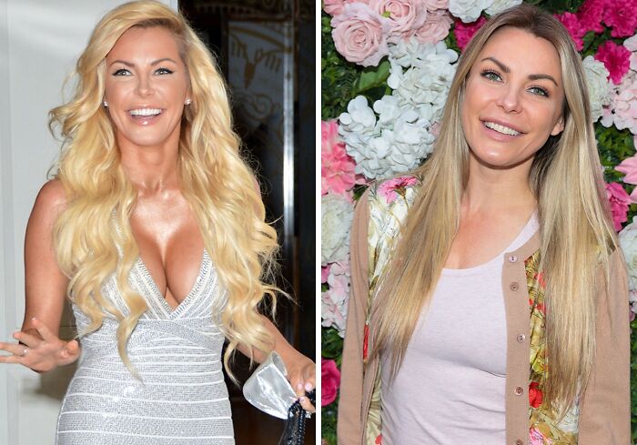 Side-by-side photo of a celebrity before and after breast implant removal, smiling in both images.