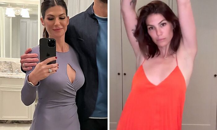 Two photos of a person, before and after breast implant removal, in different outfits.