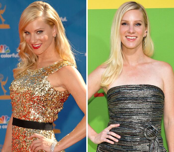 Two side-by-side photos of a celebrity who had breast implants removed, showing changes in appearance.