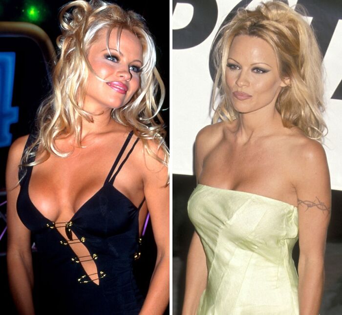 Side-by-side of a celebrity before and after breast implant removal, showcasing fashion and hairstyle changes.