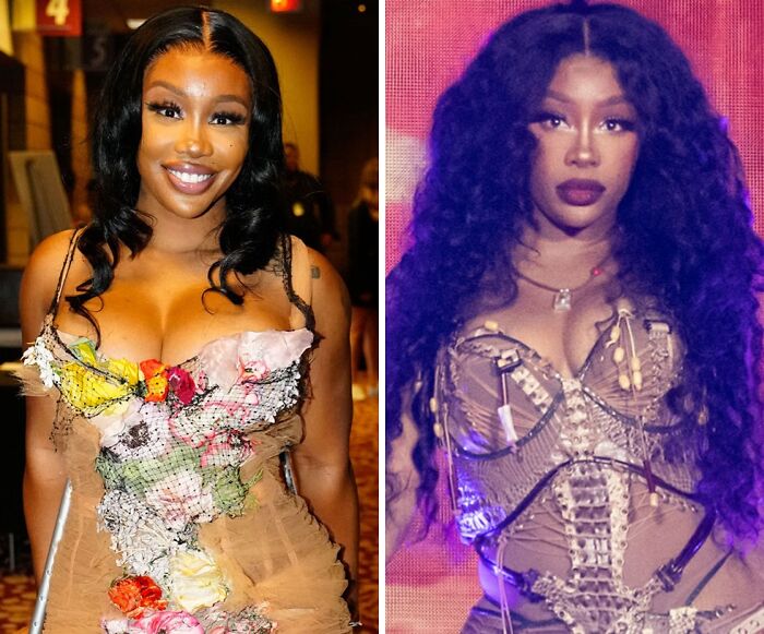 Side-by-side of a woman before and after breast implant removal, wearing floral and corset-style dresses.