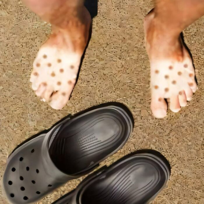 Feet with dot patterns from wearing Crocs, depicting a humorous moment in random images on Instagram.
