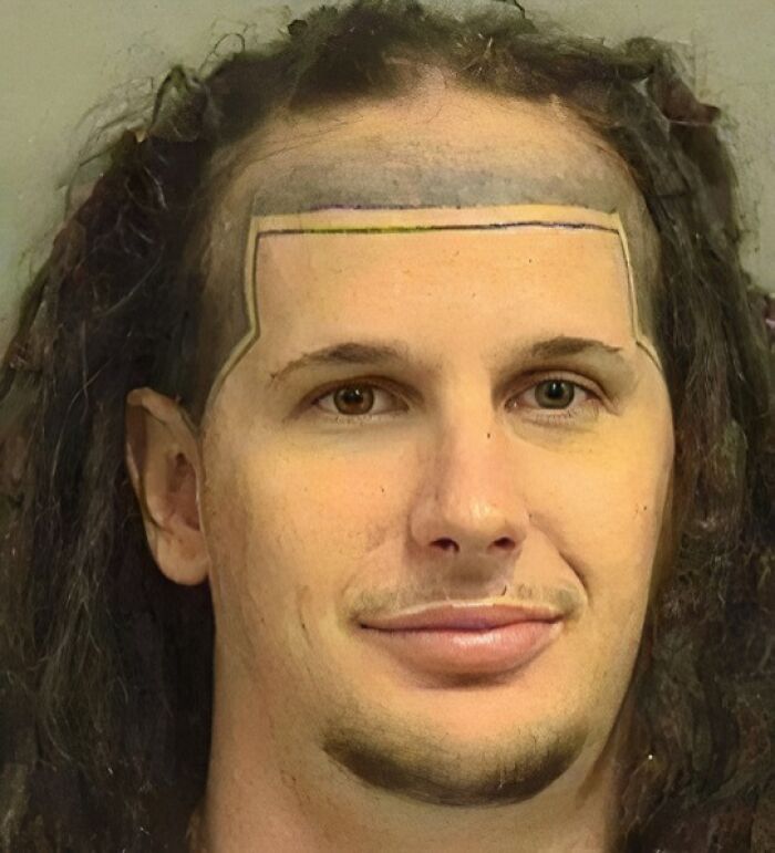 Man with a rectangular tattoo outline on forehead, exemplifying permanent mistakes inked on bodies.
