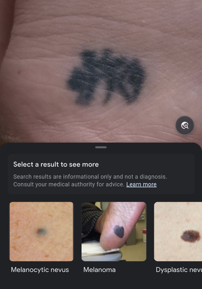 Close-up of a wild tattoo fail on skin showing a blurry and unclear ink design, highlighting tattoo mistakes.