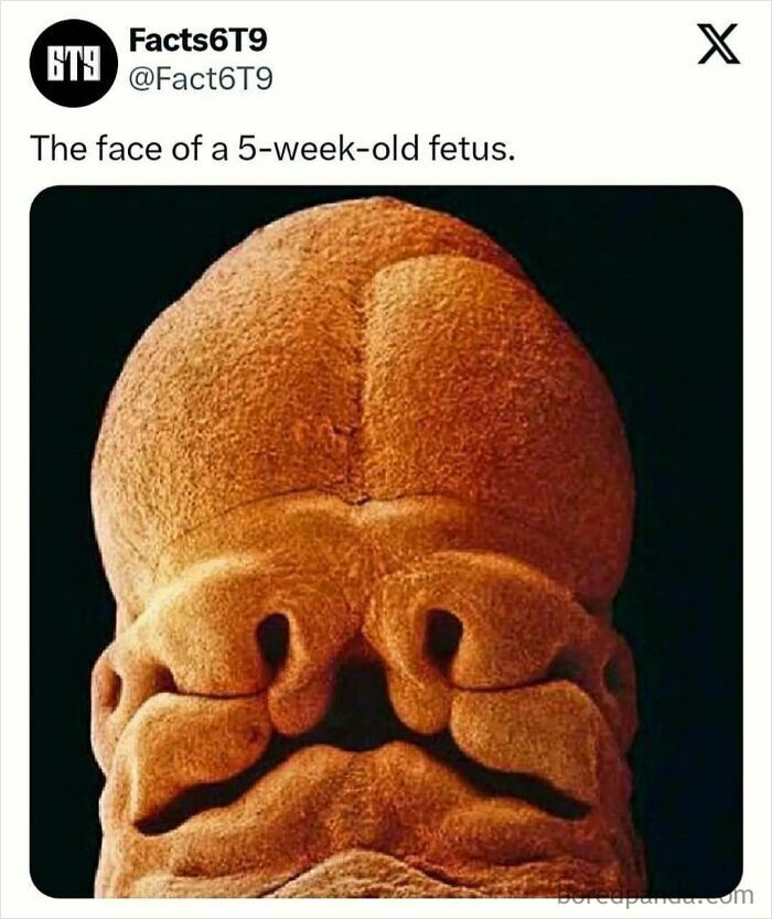 Close-up of a 5-week-old fetus's face, showing early features.