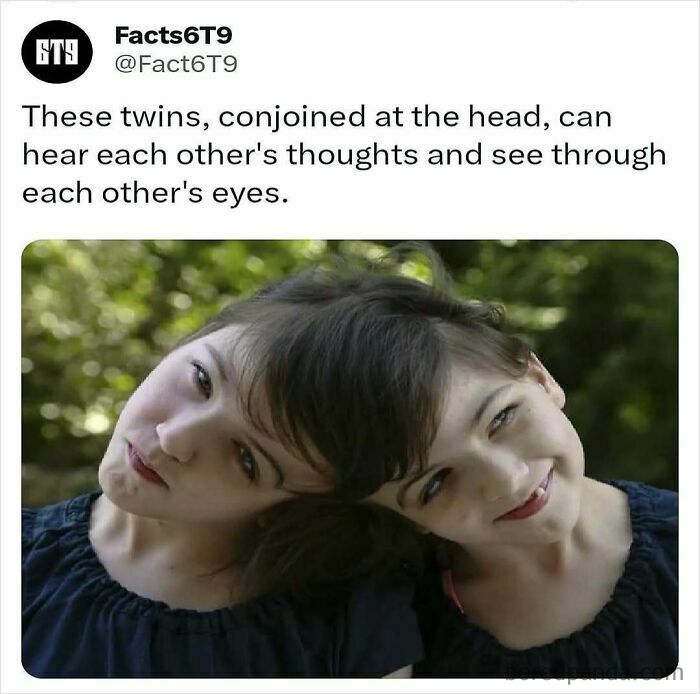 Twins conjoined at the head, dressed in blue, outdoors.