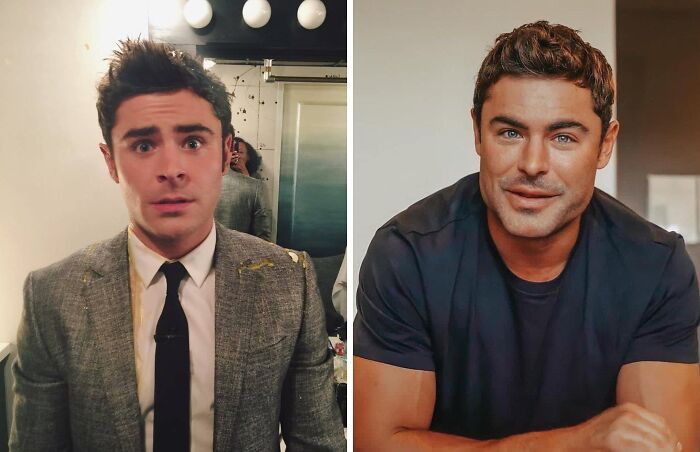 Actor Zac Efron in before and after photos illustrating celebrities before and after plastic surgery transformations.