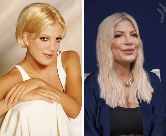 Celebrities before and after plastic surgery showing changes in appearance and style over time.