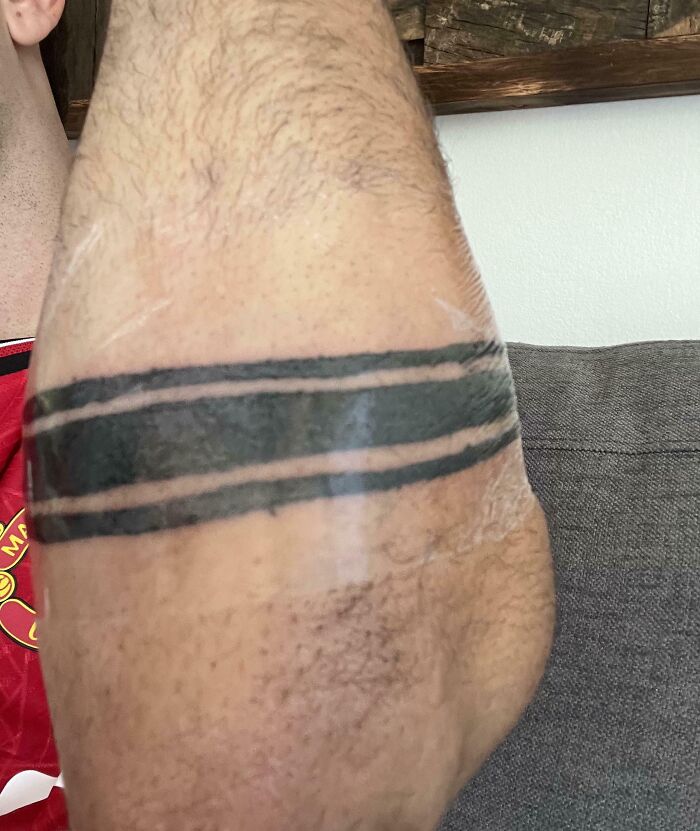 Close-up of a wild tattoo fail on a person's arm showing uneven black lines wrapped around the elbow area.