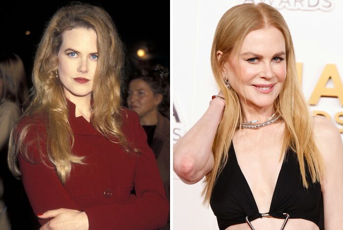 Side-by-side comparison of a female celebrity before and after plastic surgery showing changes in appearance and style.