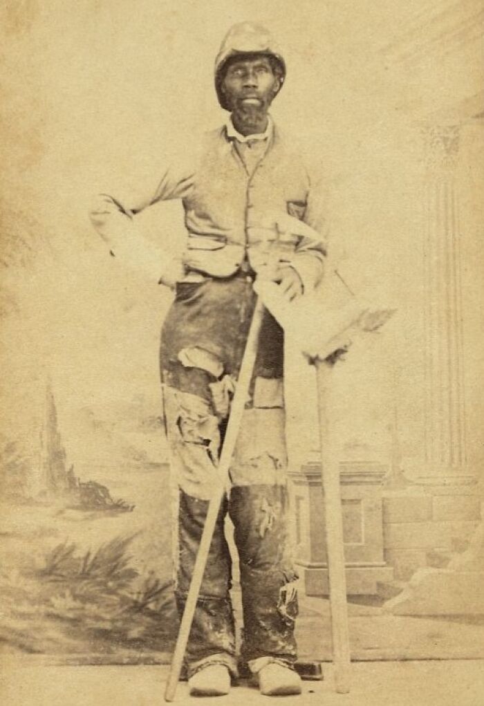 African American man with crutches and worn clothing standing in a historic sepia photo showing strength and resilience.
