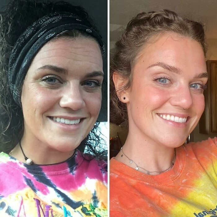 Side-by-side photos of a woman showing small appearance changes that made a big difference for her smile and skin.