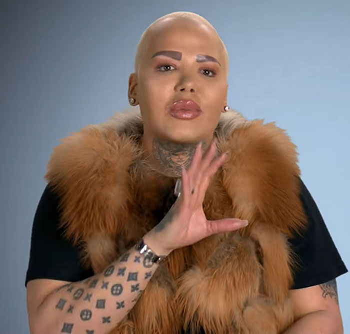 Tattooed individual with short hair and fur vest gestures, relating to a plastic surgery incident.