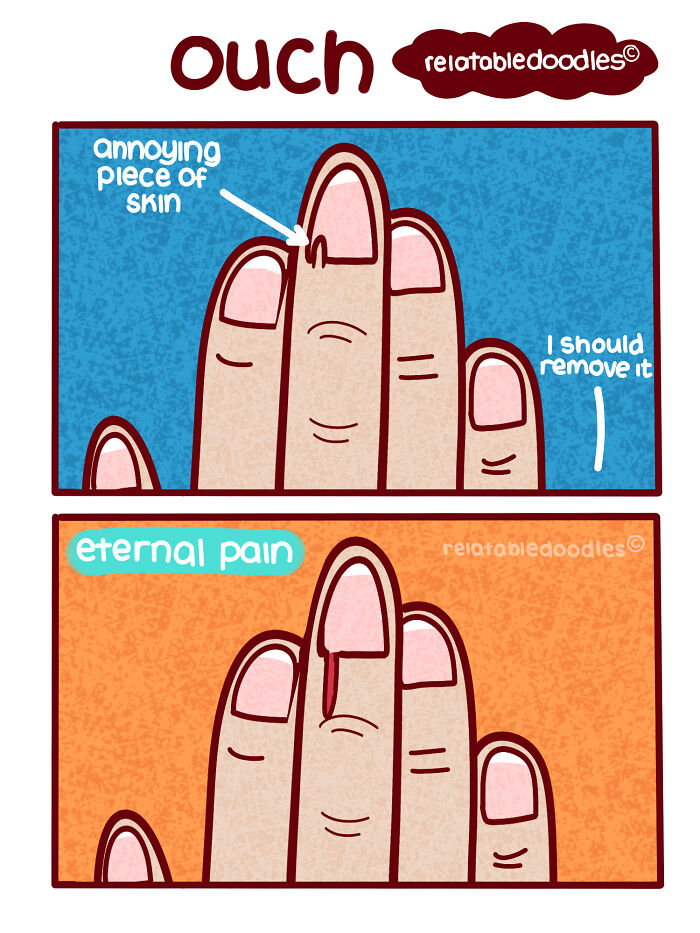 Cartoon of a finger with a hangnail, humorously depicting relatable everyday life pain.