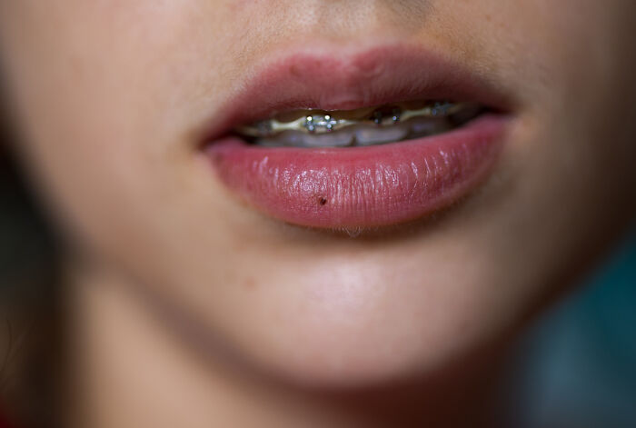 Braces From The Series Seasons Of Time By Nathalie Rubens