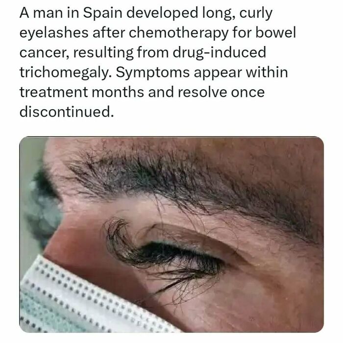Close-up of a person with long, curly eyelashes after chemotherapy; a surprising fact for a fun brain workout.