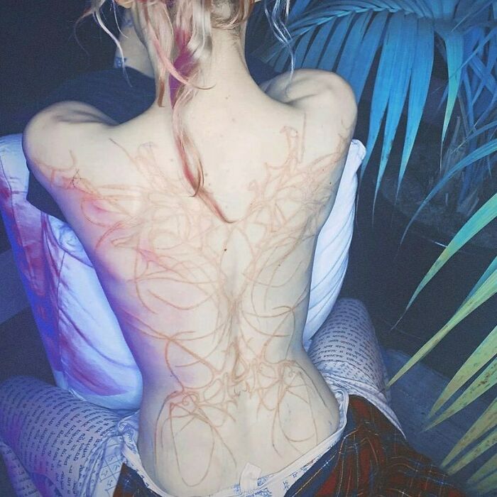 A back tattoo with abstract ink design, showing a permanent tattoo mistake under blue lighting conditions.