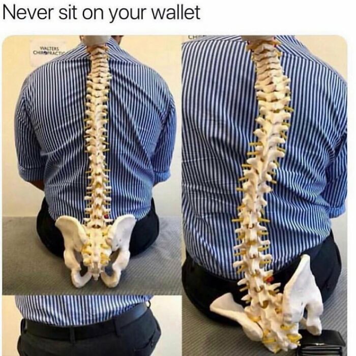 Medical school meme: Man in striped shirt with a spine model overlay, highlighting effects of sitting on a wallet.